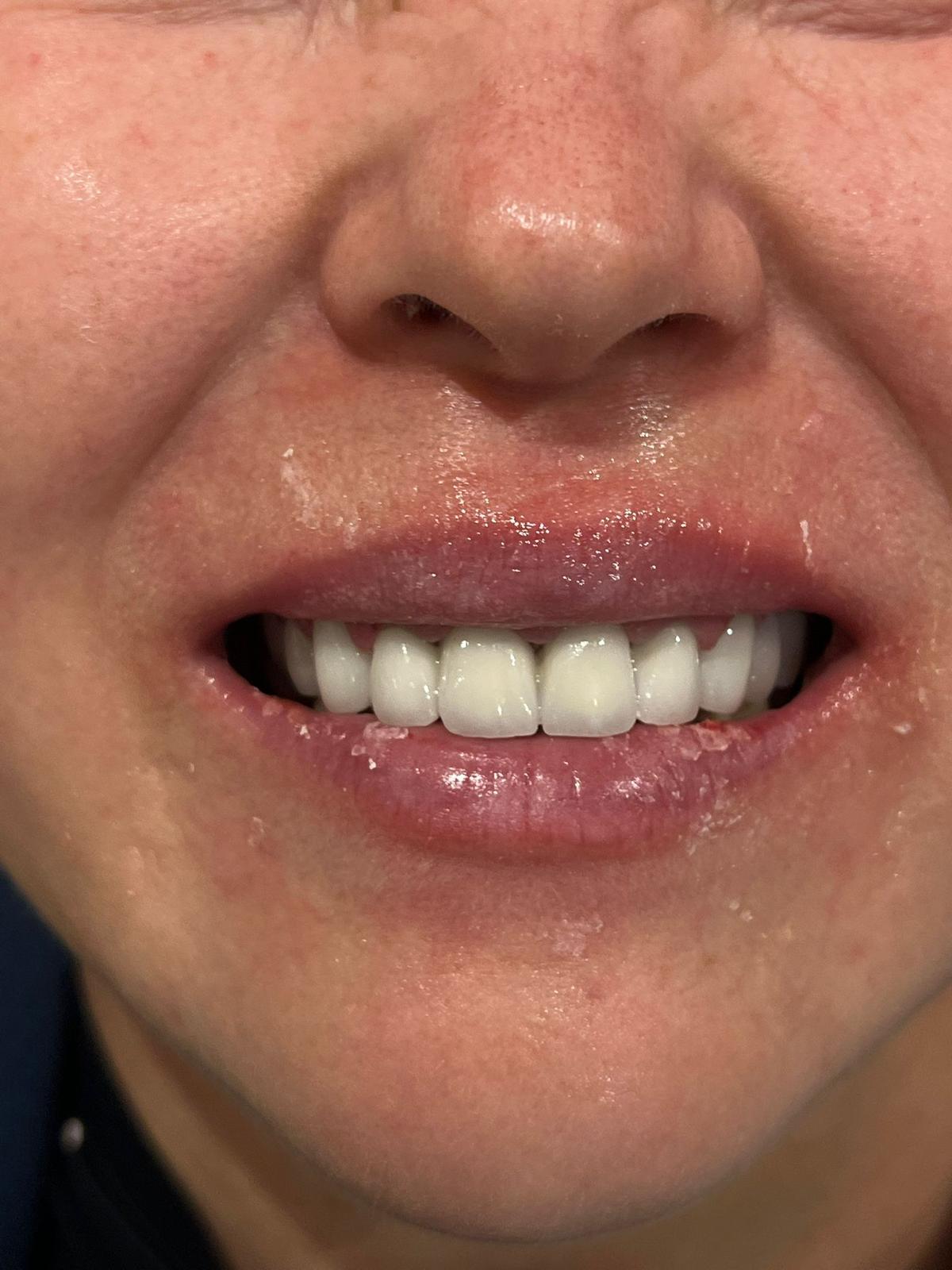 ECE Dental Patient Transformation